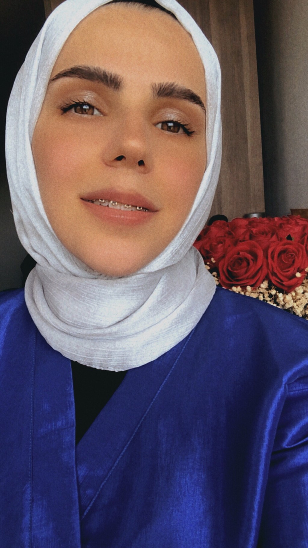 Diş Teli Kullananlara Renk Tavsiyeleri&nbsp;[Görsel]